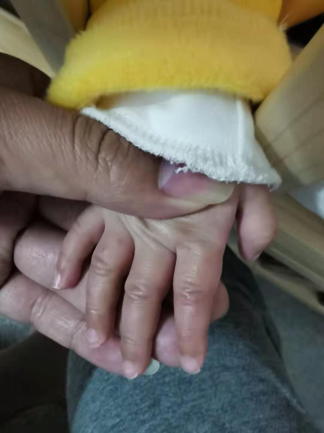 五个月宝宝手红肿了怎么回事,5个月宝宝手突然红肿是怎么回事