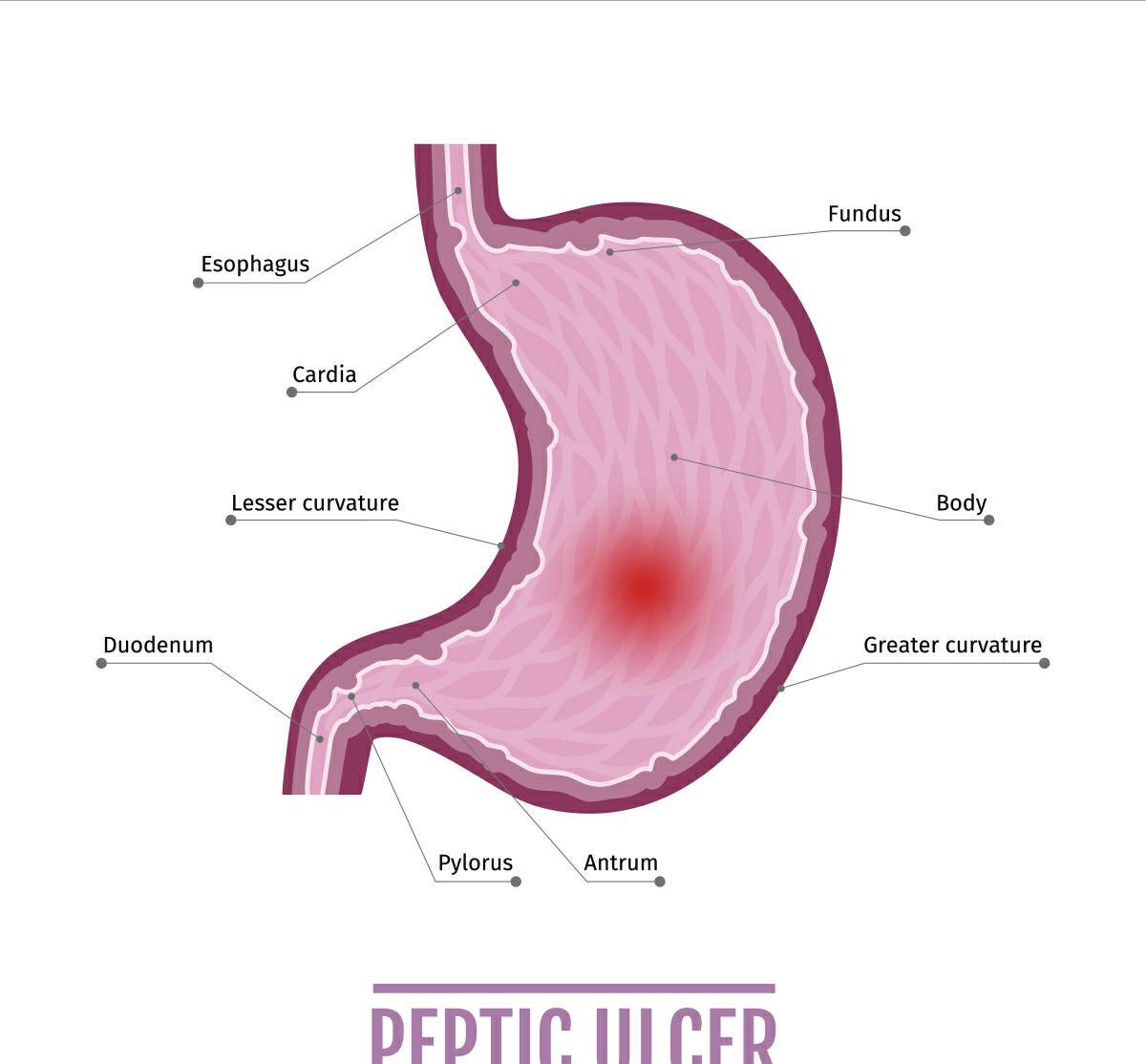 胃的结构图科普,胃结构图解大全