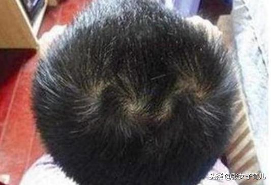 宝宝头旋处脑袋很平,宝宝脑袋跳动的叫什么