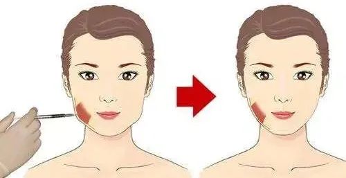 左右脸不对称怎么自我矫正,左右脸严重不对称及时调整体态