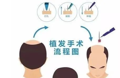 出现脱发怎么办挽救秀发,出现脱发