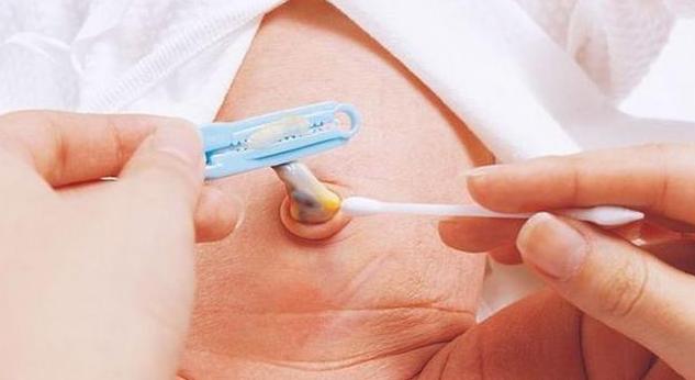 新生儿肚脐眼出血如何消毒,新生儿肚脐眼碘伏消毒出血了