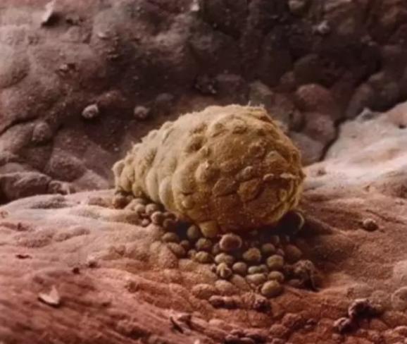 一个婴儿诞生的全过程,婴儿诞生全过程视频