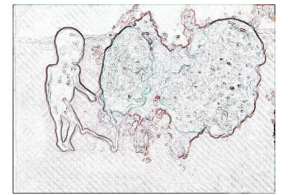 极为罕见！怀了双胞胎，却有一个是葡萄胎？高龄宝妈葡萄胎16周成功引产于阴道分娩
