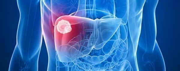 为什么肝血管瘤医生建议不用管,有了肝血管瘤要注意什么