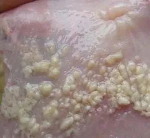 白色念珠菌用什么药剂治疗效果好,白色念珠球菌忌什么