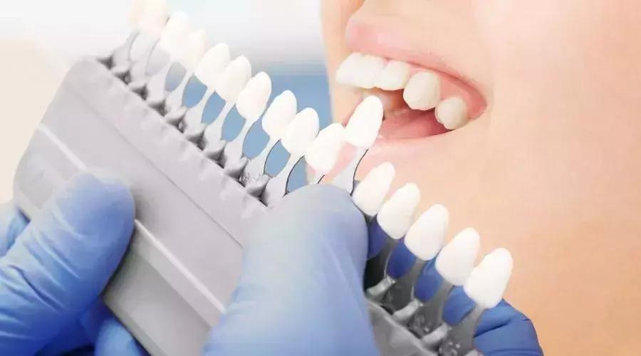 抖音上的美牙神器有用吗,使用美牙仪的抖音网红