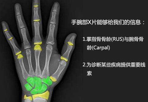 省医院李丽曼简介,河南省医院儿科李丽曼