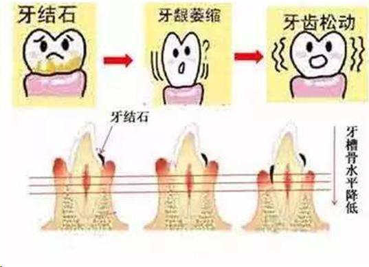 做到了这一点,口臭不找你麻烦…
