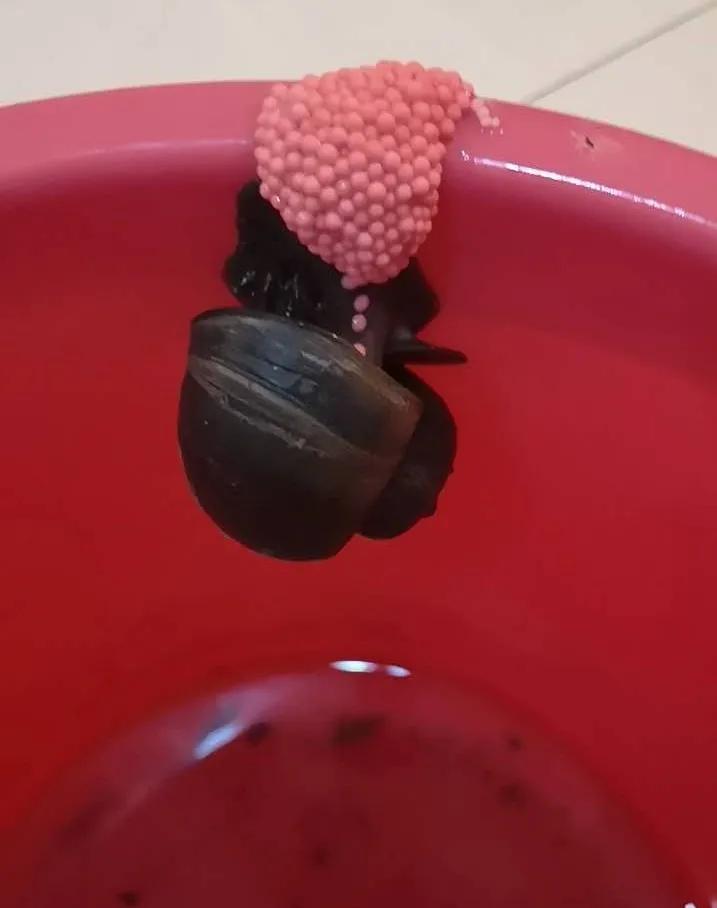 很多食物都有寄生虫,哪些寄生虫会造成生命危险