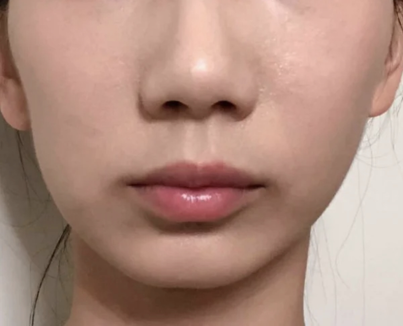 大小脸改善大方脸,大小脸是改善大脸还是改善小脸