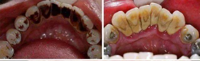 倪妮泳装露齿笑又迷倒一票人！湿法风格突然走火，牙白才敢这样玩