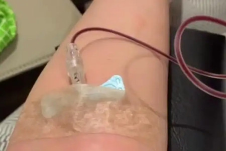 舒淇过敏原因,舒淇过敏脸是怎么好的