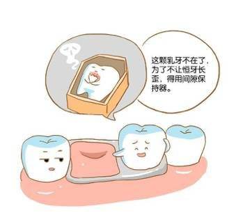 为迟来的恒牙占座—亿佰君谈间隙保持器