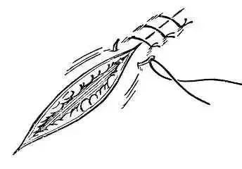 外科8种缝合方法图解,外科基本缝合方法实验报告