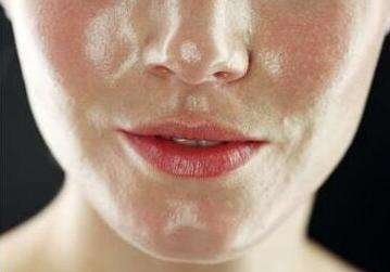 油光型毛孔粗大护肤步骤,收缩毛孔粗大的方法干皮敏感肌