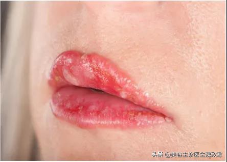 韩式纹眉有哪些种类,韩式纹眉痛吗