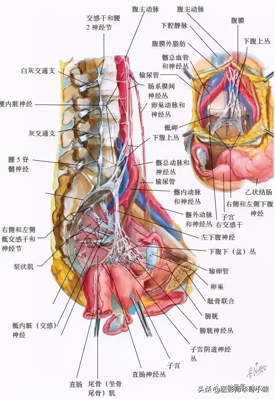 女性盆腔核磁解剖图谱,正常盆腔ct解剖图谱