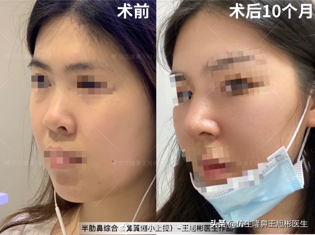 被鼻子封印的颜值,那些被鼻子封印的颜值