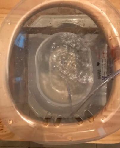 痔疮手术的感慨,一个做过4次痔疮手术的人