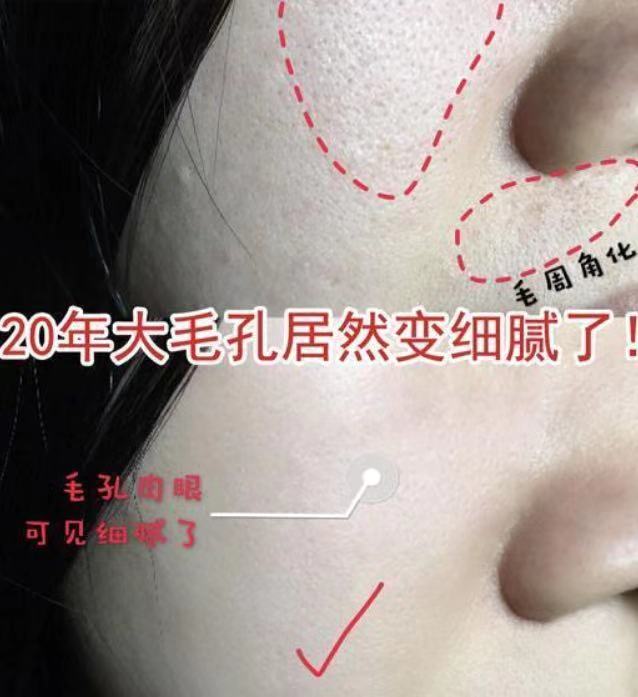 国宝级美容仪李佳琦,李佳琦讲美容仪