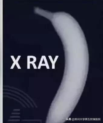 ct胶片的种类,ct胶片有利用价值吗