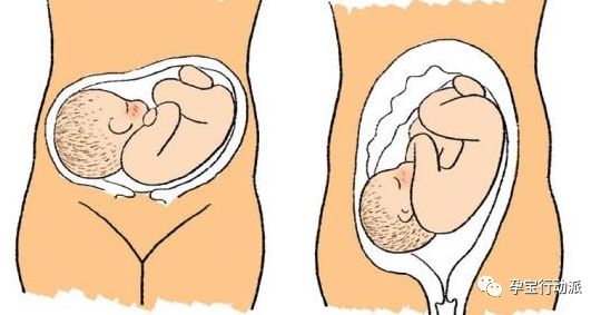 孕期周刊第93周,孕期日记第三十六天