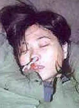 触目惊心吸毒前后真实的对比,吸毒前后可怕容貌变化