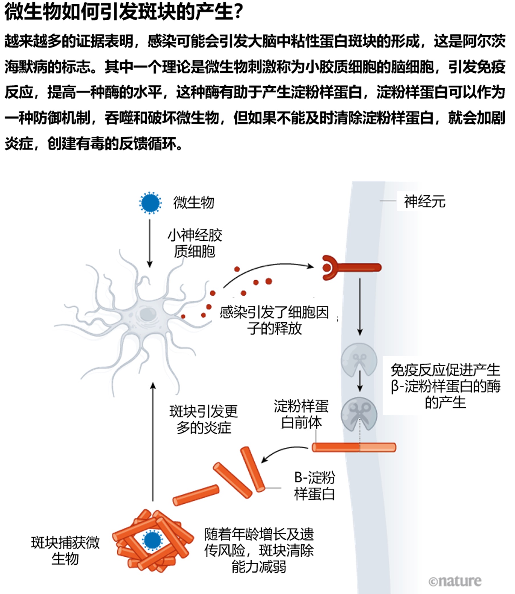 阿尔茨海默病与tau蛋白有关吗,淀粉样蛋白与阿尔茨海默病