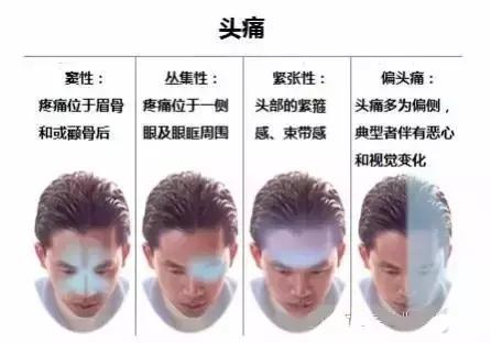 面神经分布图片大全,怎么记住面神经分布