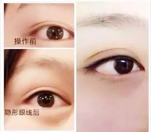 美瞳线在眼上，无妆胜有妆