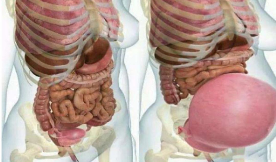 孕妇肚子痛不停把胎儿往肚子里挤,孕妇肚子大了还能蹲便吗