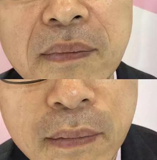 补水保湿淡化黑眼圈眼袋,黑眼袋黑眼圈用什么护肤品消除