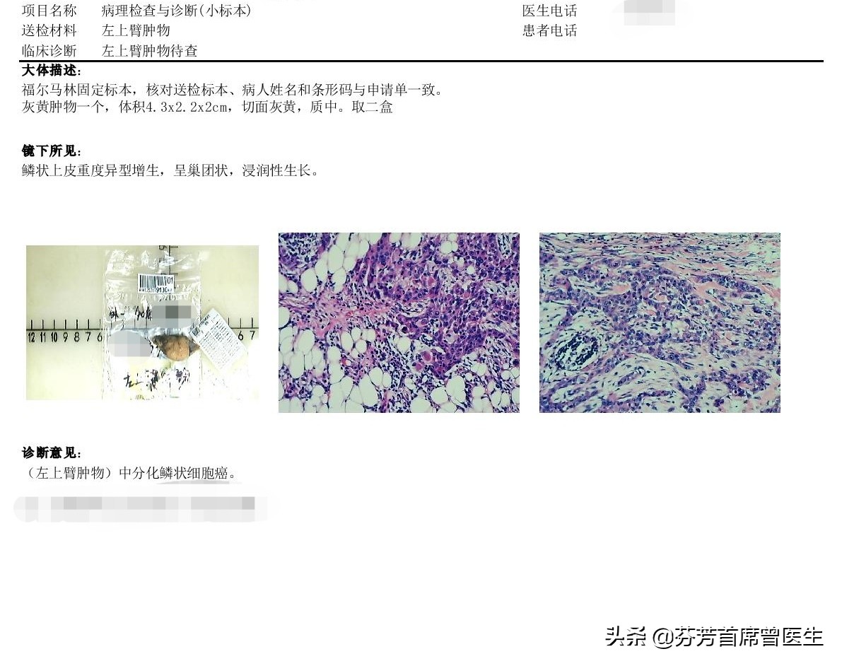 手臂长疙瘩一直不好,手臂长了疙瘩结疤又不愈合