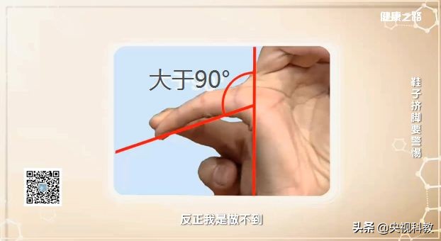 让你又丑又疼的拇外翻矫正方法在这里！还有测试哦