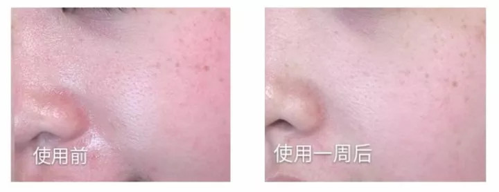 张馨予超爱的品牌！99元的眼霜，就能改善黑眼圈、干纹！