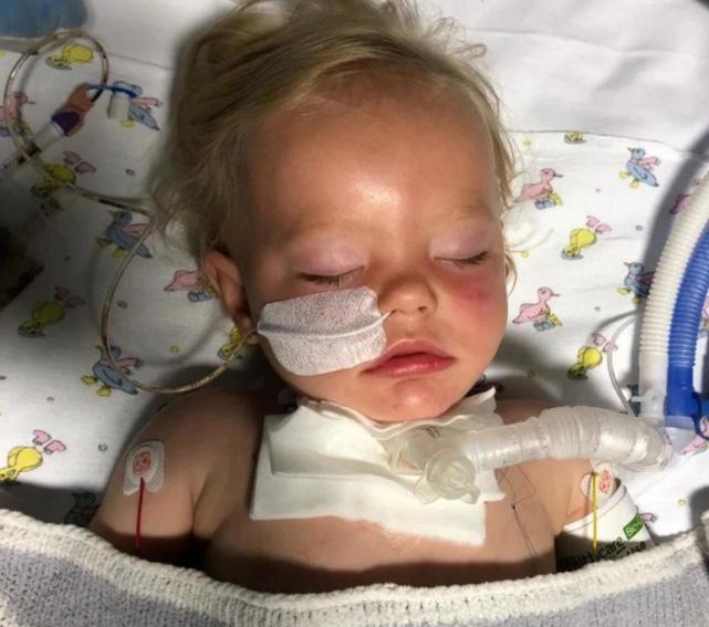 小孩被玻璃杯砸到头还出血怎么办,小孩拿杯子被割伤