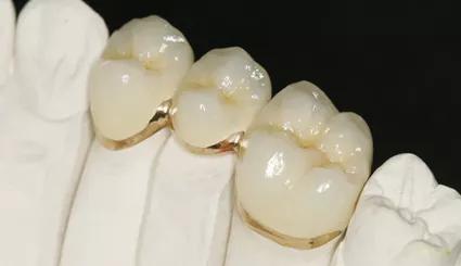 老人牙齿变长,老年人牙齿越大越容易出问题