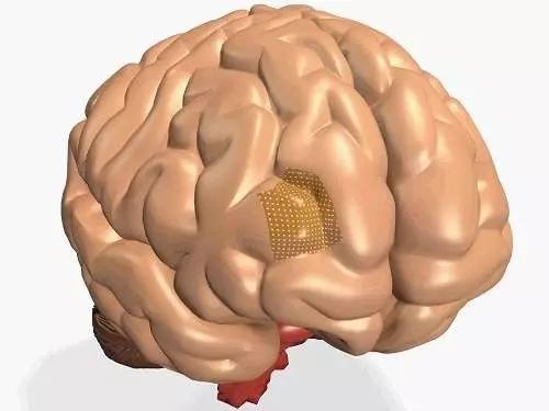 神经疾病患者的福音：加州大学伯克利分校开发出新型神经刺激器！