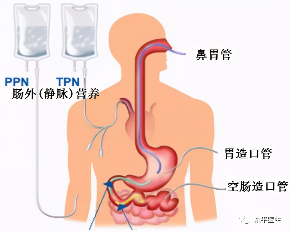 什么是临床营养支持？包括哪些方面？