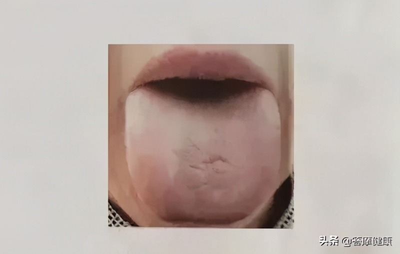 阳虚体质夏天如何温阳,阳虚阴虚阳气不足靠练能改善吗