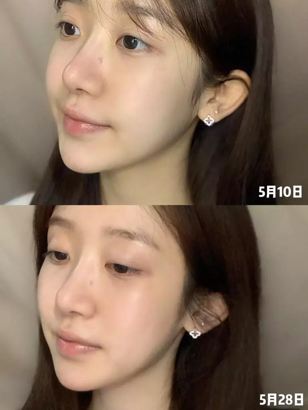 精华原液成分怎么选,精华好用的成分推荐