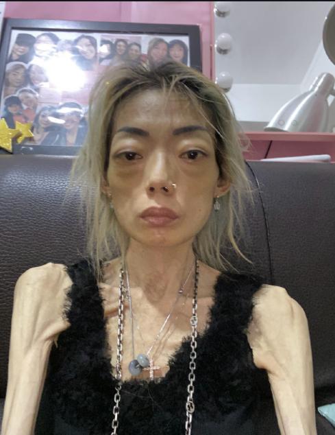 为嫁豪门穿了30年瘦身衣,22岁嫁入豪门减肥暴瘦44斤