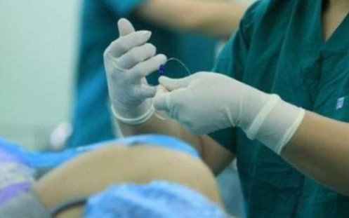 顺产备皮以后毛孔一圈起皮,为什么顺产备皮不要刮干净