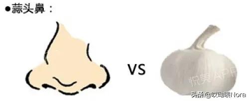 最自然的小翘鼻,鼻综合小翘鼻图片