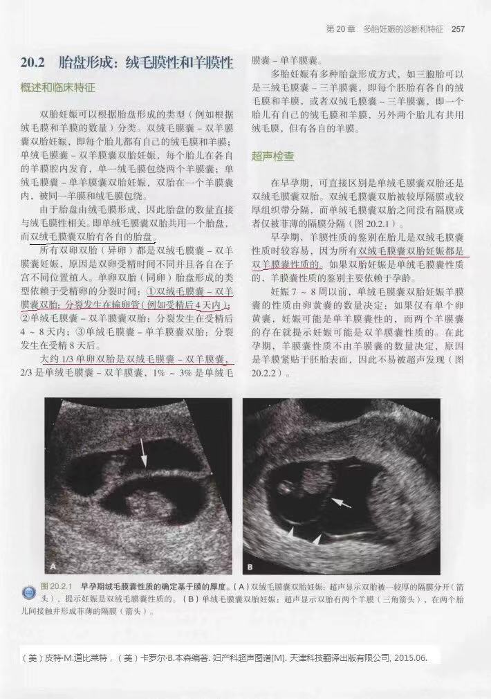 两个胎盘的双胞胎是同卵还是异卵,双胞胎一个胎盘有几条脐带