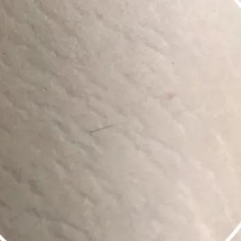 又到了穿小裙的季节，鸡皮女孩该怎么办……