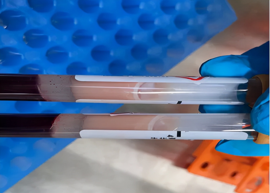 “游走”在全身的油脂，可能随时抢夺你的生命