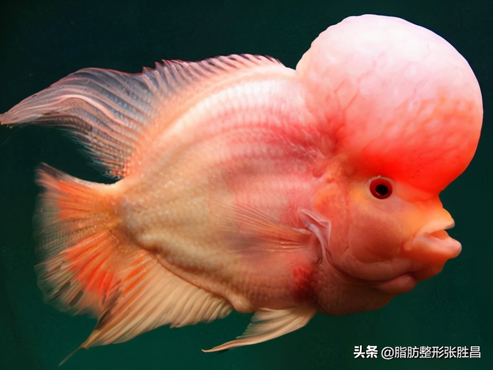 自体脂肪填充变丑了怎么办,自体脂肪填充面部会造成面部变形