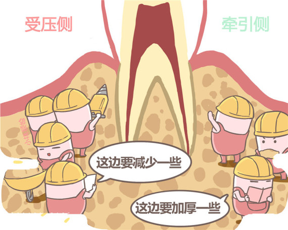 儿童牙齿正畸会引起牙槽骨吸收吗,正畸造成的牙槽骨吸收怎么治疗
